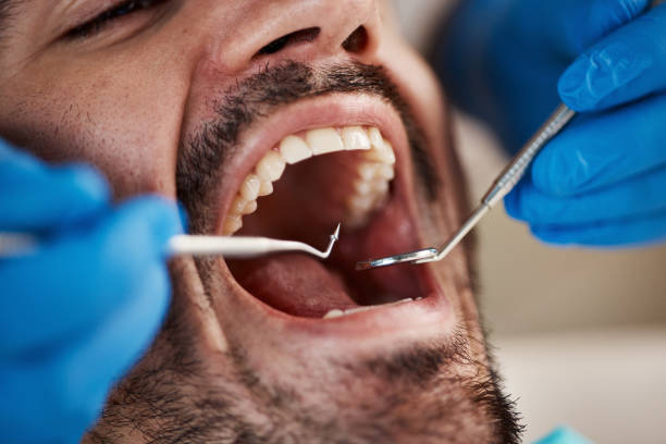 Best Emergency TMJ Treatment in Macon, IL