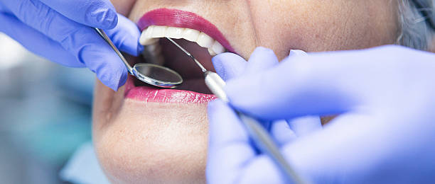 Best Emergency Tooth Extraction in Macon, IL